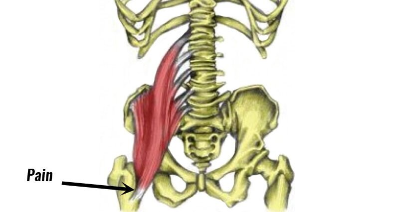 Hip Anatomy: Iliopsoas
