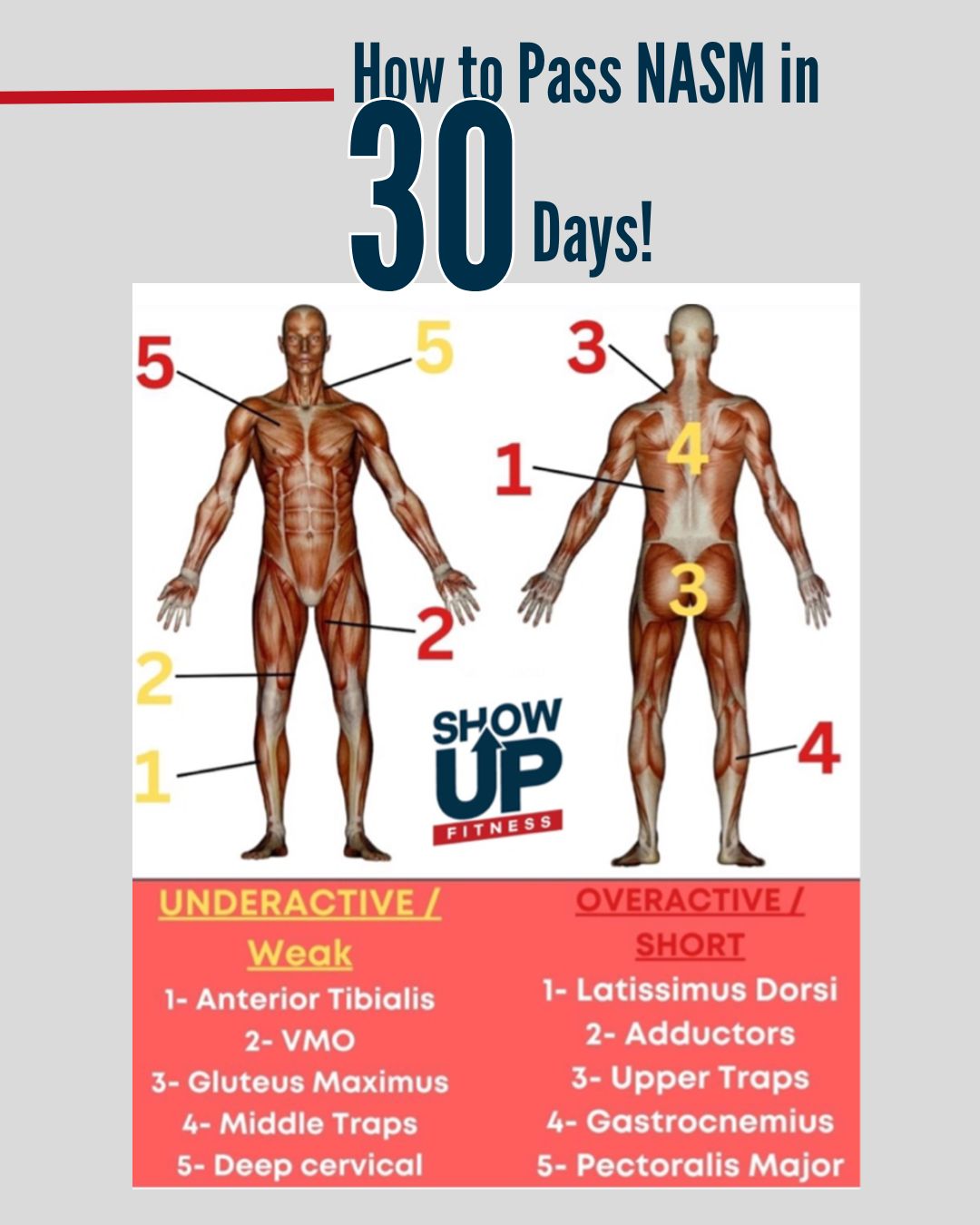 How to Pass NASM in 30-days: Knee Valgus / Lower Crossed Syndrome